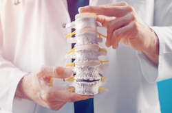 Миф 4: остеопороз влияет только на спину.