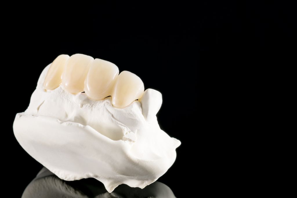 closeup-prosthodontics-prosthetic-tooth-crown-bridge-implant-dentistry-equipment-model-express-fix-restoration.jpg