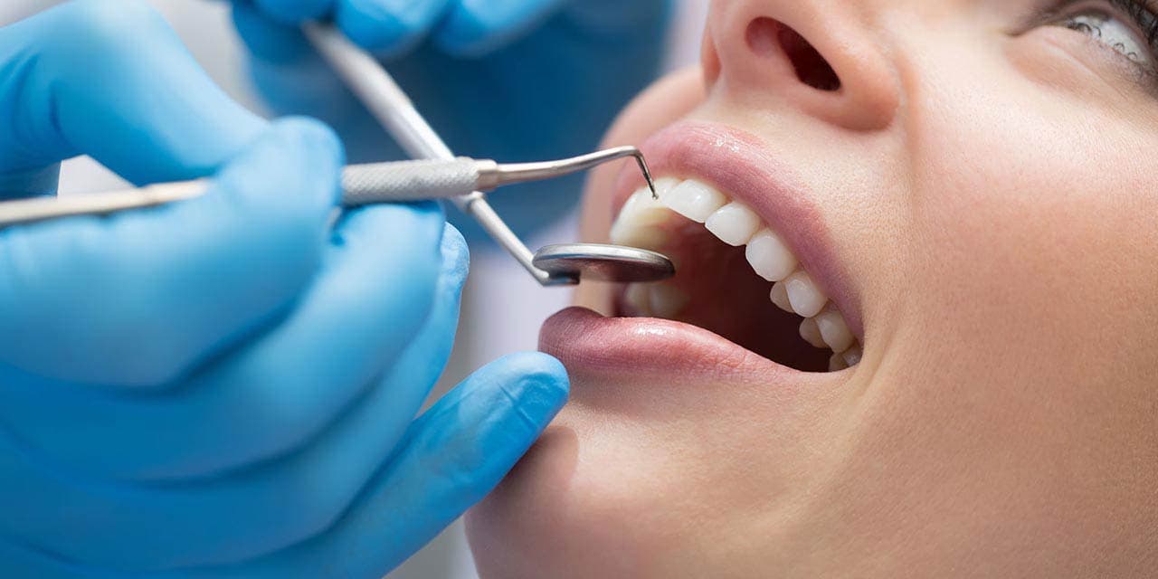 Лечение кариеса передних зубов