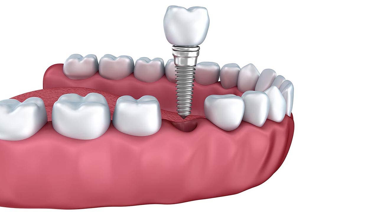 Ортопедическая стоматология и протезирование