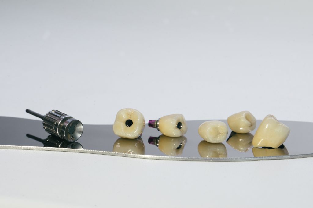 zirconium-crown-zirconium-hybrid-abutment-monolithic-screw-retained-zirconium-crown-implant-screw-manual-key-screwing-crown.jpg